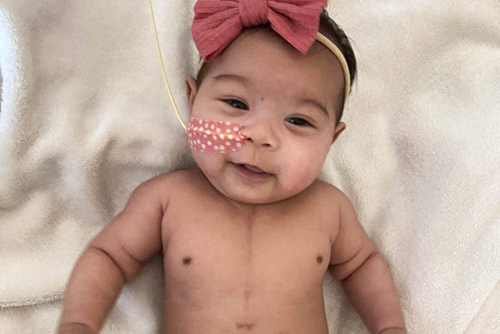 Happy half Asian baby girl with slight smile, pink bow headband, pink polka dot NG tube tape on cheek, laying on white fleece blanket, open heart surgery scar on chest