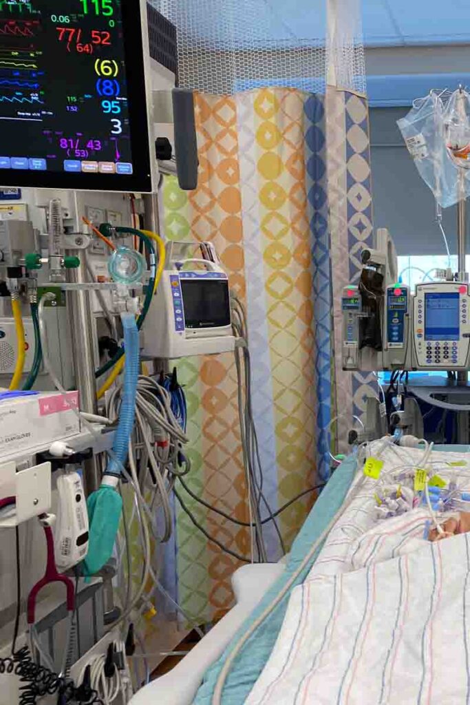 An up-close image of a child's cardiac ICU room with various medical equipment. There are several monitors displaying vital signs with numbers and graphs, indicating heart rate, oxygen saturation, and other critical parameters. A hospital crib with only one small hand is partially visible, surrounded by tubes and IV lines, highlighting a highly controlled and monitored medical environment.